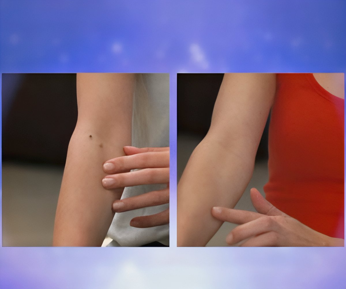 Skin Patch 2x1 a 49,99€ packshot