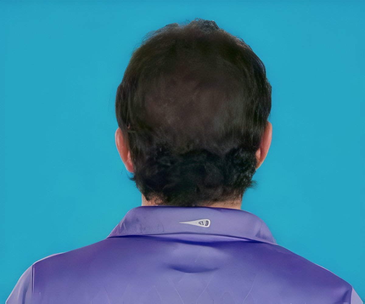 Hair Grow Max 2x1 a 20.021,60 HUF packshot