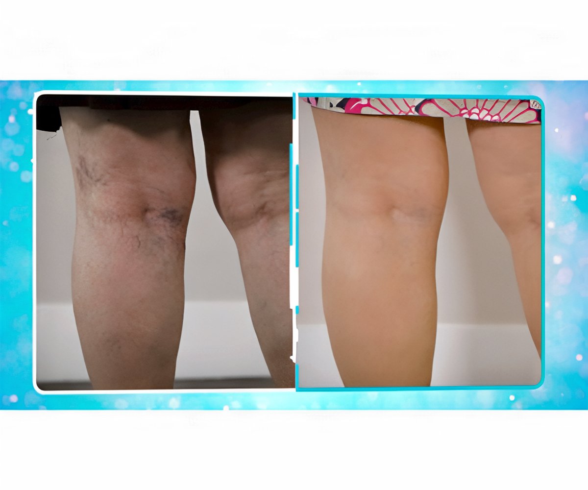 Veins Gone 2x1 a 39,99€ packshot