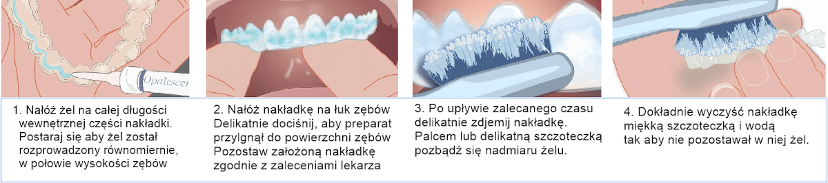 zestaw Opalescence