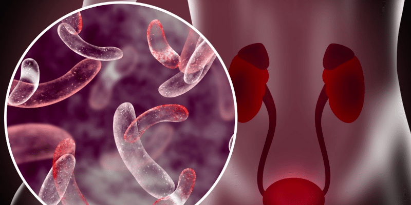 Urobiol